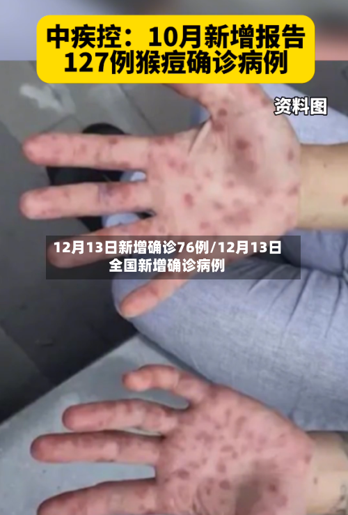 12月13日新增确诊76例/12月13日全国新增确诊病例