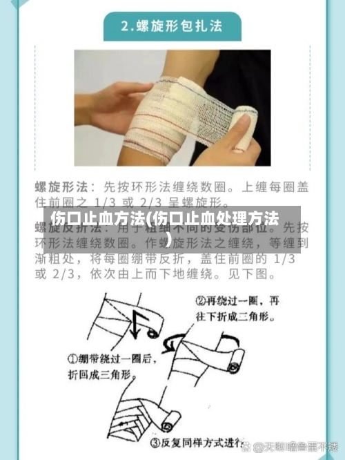 伤口止血方法(伤口止血处理方法)-第2张图片